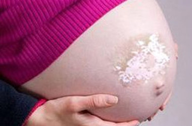 怀孕期间得了白癜风会有哪些影响?